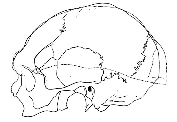 typische schedel van de ‘Batavus genuinus’,